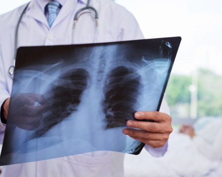 Стартира кампания за безплатни прегледи за туберкулоза в страната