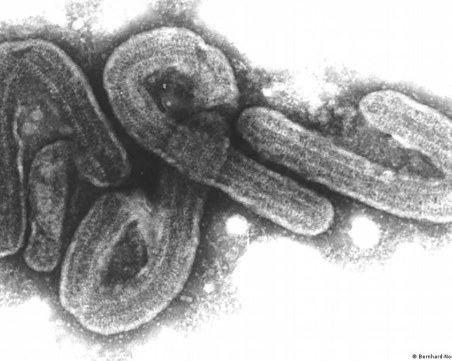 СЗО: Още осем случая на марбургска хеморагична треска в Екваториална Гвинея