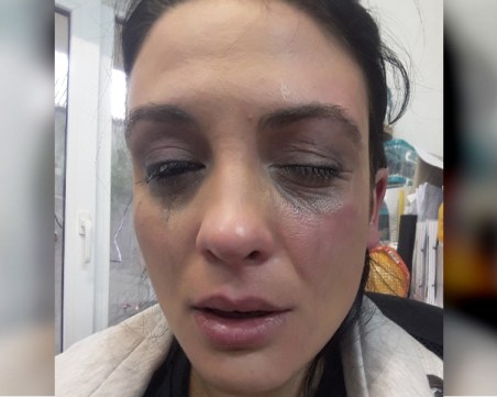 Актрисата Диана Димитрова: Претърпях насилие и няма да мълча, ще отидем на съд