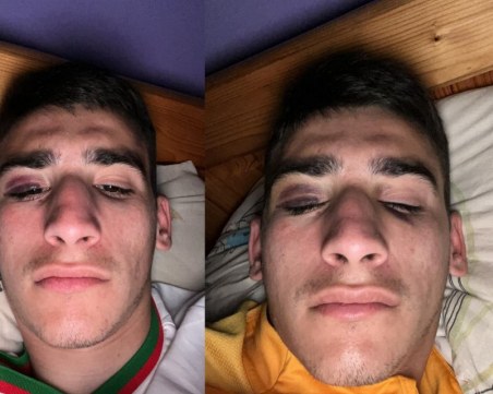 Пребиха футболист на Черно море по погрешка