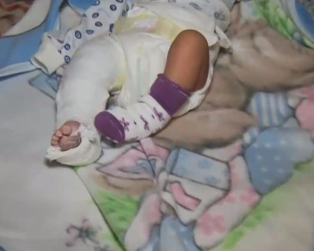 Приеха в болница новородено с жълтеница, изписаха го със счупен крак