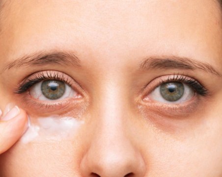 Как да се справим с тъмните кръгове под очите с естествени средства?