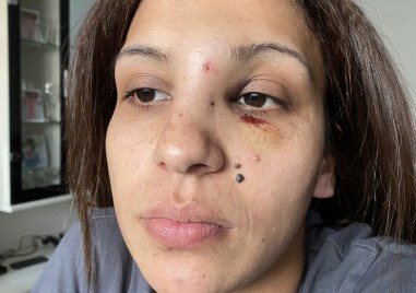 Пореден сигнал за домашно насилие разтърси социалните мрежи 25 годишна жена