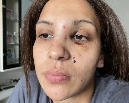 Жена твърди, че е бита от бившия ѝ съпруг пред детето им