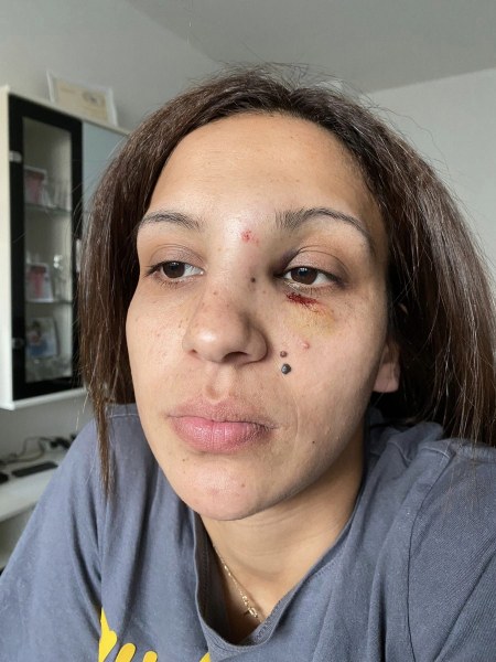 Жена твърди, че е бита от бившия ѝ съпруг пред детето им