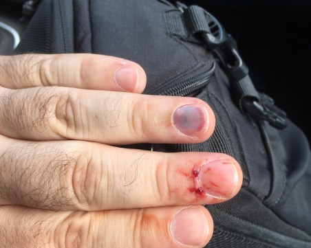 Премазаха пръстите на пловдивчанин в манастир в Северна Македония заради снимка