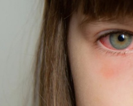 Учени откриха странен симптом на новия вариант на COVID-19