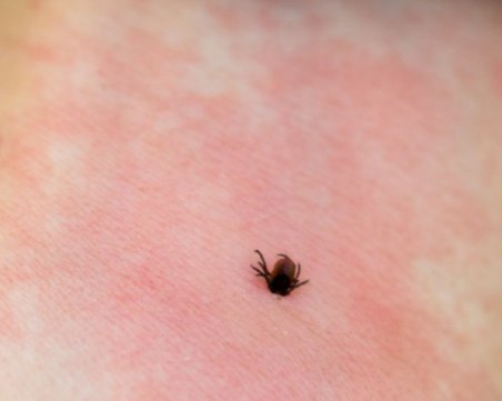 Случай на хеморагична треска във Велико Търново