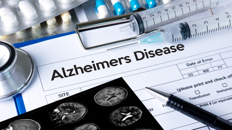 САЩ одобриха първото ефективно лекарство срещу Алцхаймер