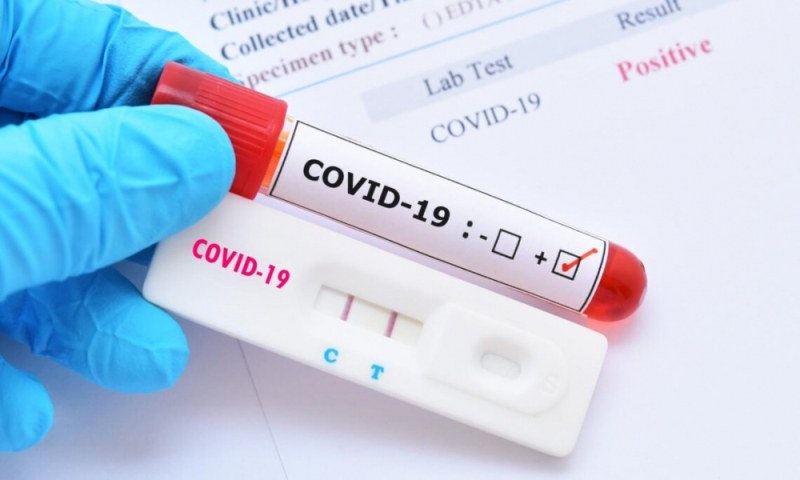 COVID в цифри: 5 нови случая