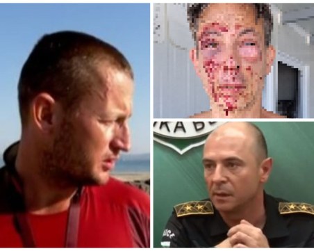 Арестуваха спасителя, пребил французина в Поморие – грозят го до 3 години затвор