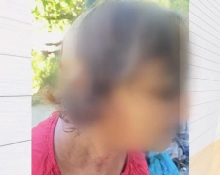 Възрастна жена е била пребита с бухалка в Оряхово