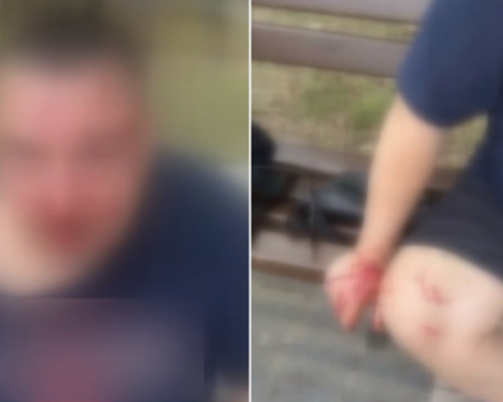 Пребитият в Ботевград: Ритаха ме, изпаднах в безсъзнание, детето ми е в шок