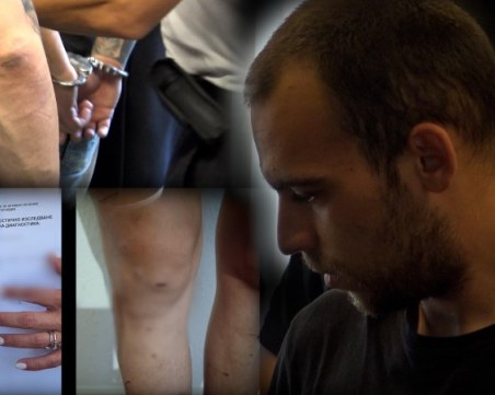 Средна, а не лека телесна повреда за пребитата млада майка от Пловдив