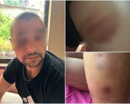 Кметът на Бачково за побойника на Атанас: Проблемен тип е, генератор на скандали