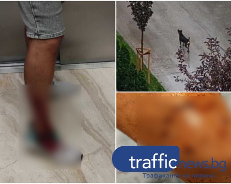 Бездомно куче разкъса крака на мъж в Смирненски, институциите нехаят вече месец