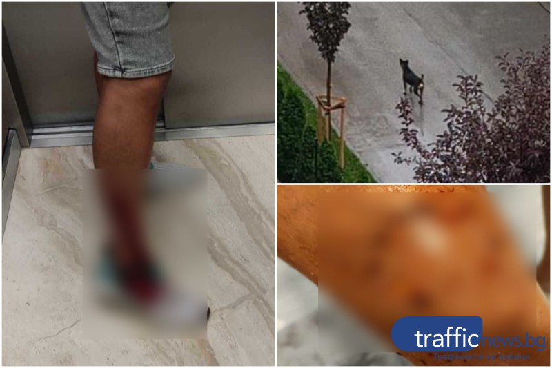 Бездомно куче разкъса крака на мъж в Смирненски, институциите нехаят вече месец