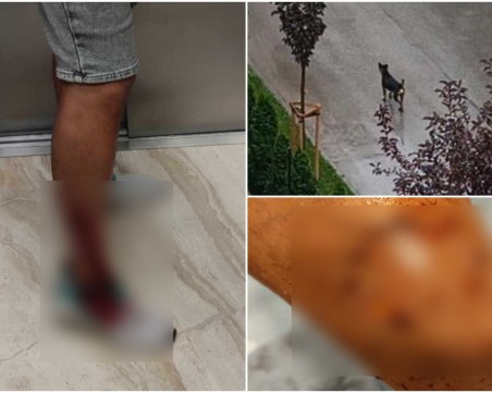 След публикация на TrafficNews: Общинският приют прибра кучето, разкъсало крака на мъж в Смирненски