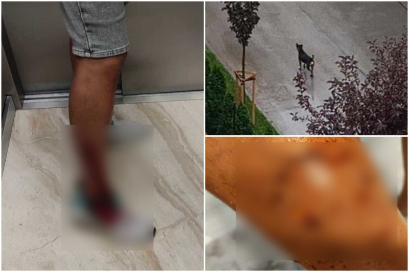След публикация на TrafficNews: Общинският приют прибра кучето, разкъсало крака на мъж в Смирненски