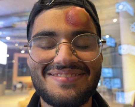 Роналдо уцели оператор след изпълнение на фаул