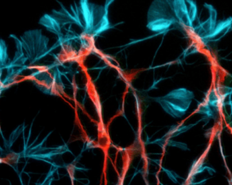 Нов поглед върху развитието на болестта на Алцхаймер може да даде ключ към нейното лечение