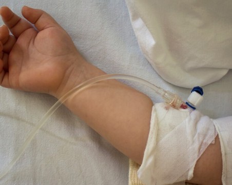 След като яли дюнери: 20 деца са приети в болница в Карлово с натравяне