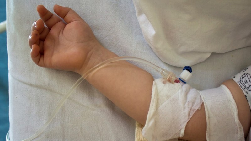 След като яли дюнери: 20 деца са приети в болница в Карлово с натравяне