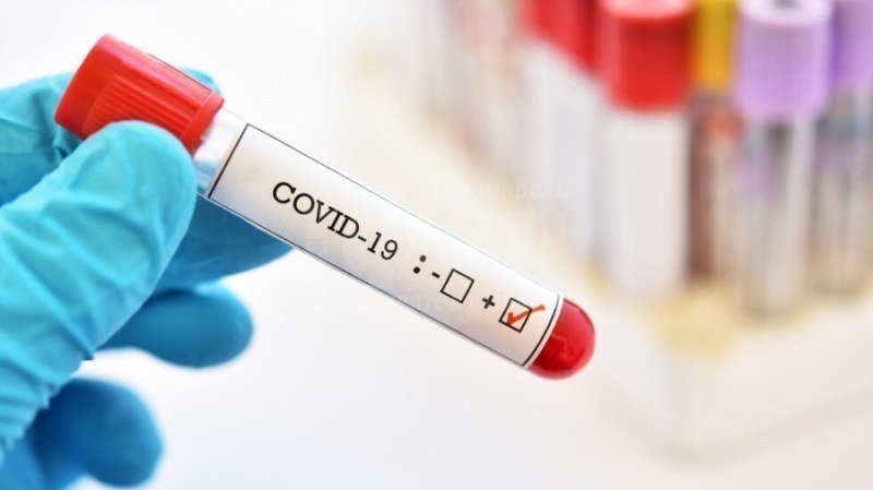 7 са новодиагностицираните с коронавирусна инфекция лица у нас през
