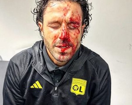 13 шева по лицето на треньора на 