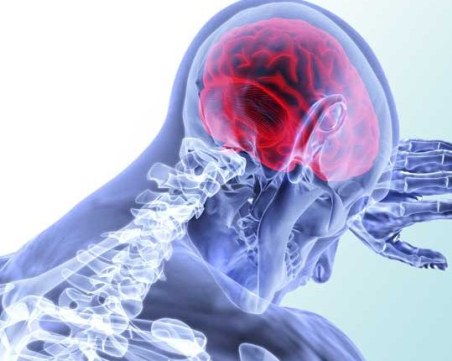 Инсултът и първите признаци: Близо 45 000 българи всяка година се сблъскват с диагнозата