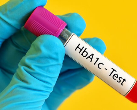 В Пловдив ще изследват безплатно гликиран хемоглобин на хора в риск от диабет