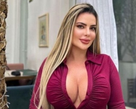 Млада жена стана неузнаваема с пластични операции, полицията не й вярва, че е тя