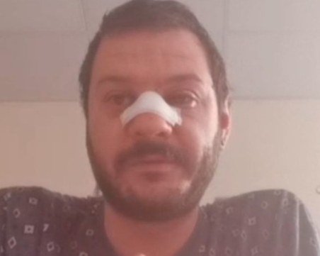 Пострадал по време на протеста в София: Удряха ме с палка, докато бях на земята