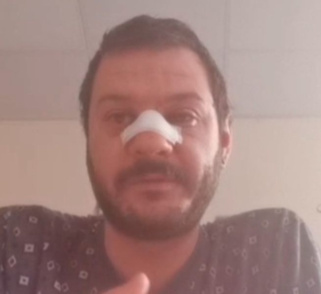 Пострадал по време на протеста в София: Удряха ме с палка, докато бях на земята