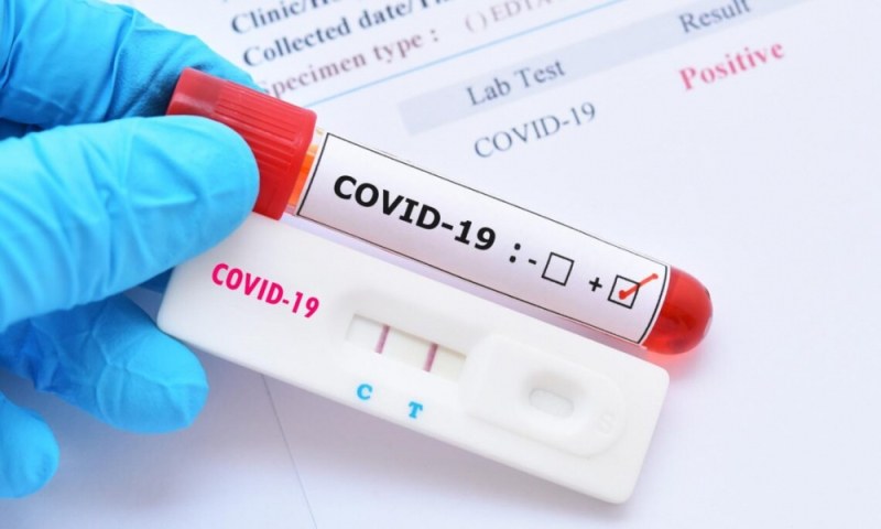 28 са новите случаи на COVID-19 в Пловдивско
