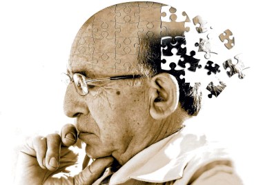 Алцхаймер е сериозно заболяване което засяга много хора Често изисква дългосрочна