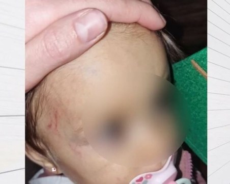 Дете на годинка е с хематом на главата след посещение на частна занималня в София