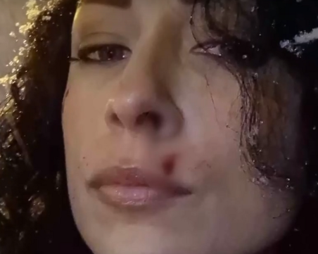 Оставиха в ареста мъжа, нарязал лицето на жена след агресия на пътя в София