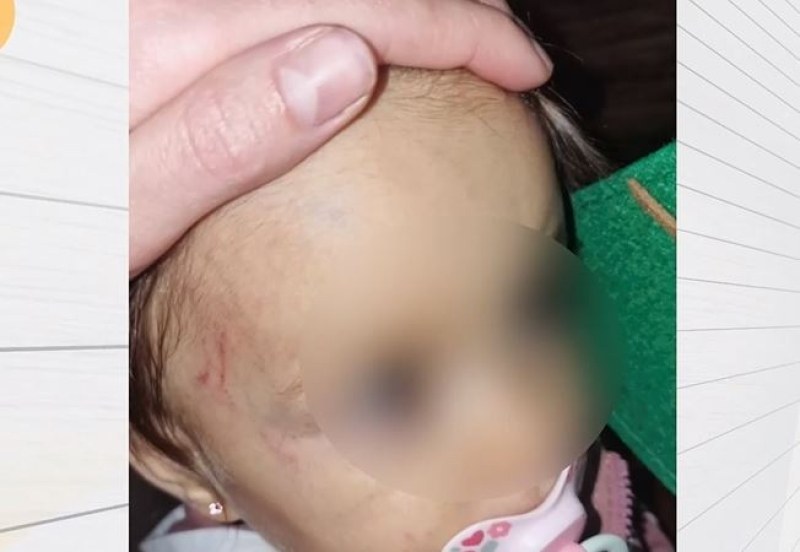 Дете на годинка е с хематом на главата след посещение на частна занималня в София