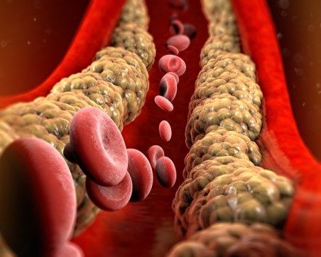 Защо трябва да държим и добрия холестерол под контрол