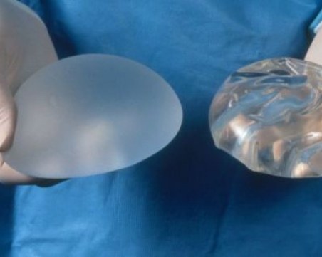 Заради дефектни гръдни импланти: Обезщетения за над 600 жени за милиони евро