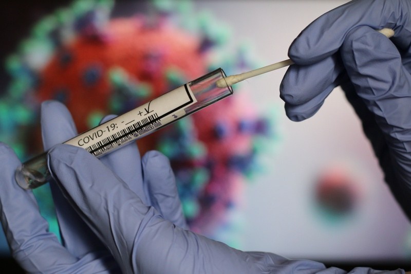 Почти 10 000 смъртни случая от коронавирус бяха регистрирани през