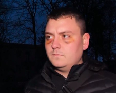 След масов бой между кукери: Жена загуби бебето си, ранен е 16-годишен младеж