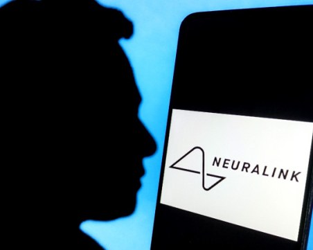 Компания на Мъск имплантира чип в мозъка на човек