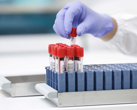 Лаборатории „Зинвест” с промоционални и безплатни изследвания