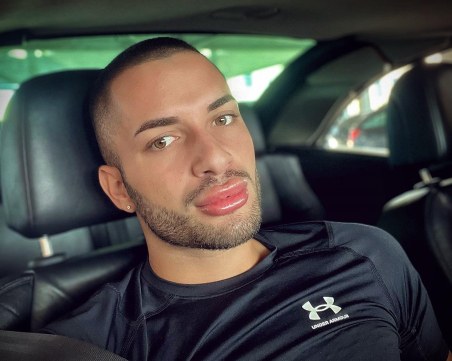 Пловдивският щангист с хиалурон в устните: Изразявам себе си и не ме е срам