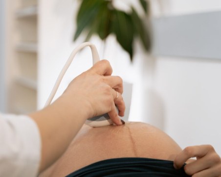 Правото на аборт на жените във Франция вече е вписано в конституцията на страната