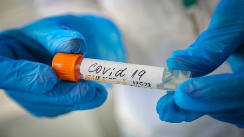 Два са новите случаи на коронавирус у нас