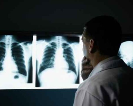 Учени създадоха ваксина срещу рак на белия дроб, която може да предотврати до 90% от случаите