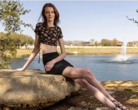 Kак живее момичето с най-дългите крака в света